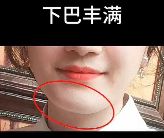 瘦反而有雙下巴面相