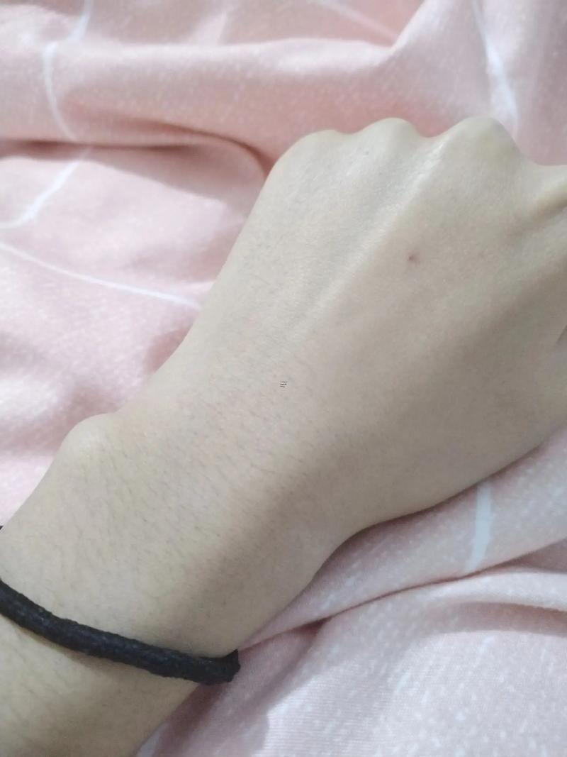 朱砂痣是什么東西樣子