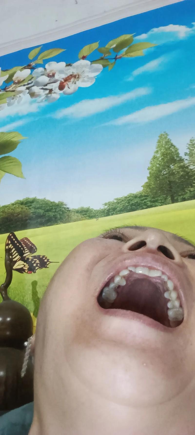 夢見牙齒碎了一小塊一小塊掉出來